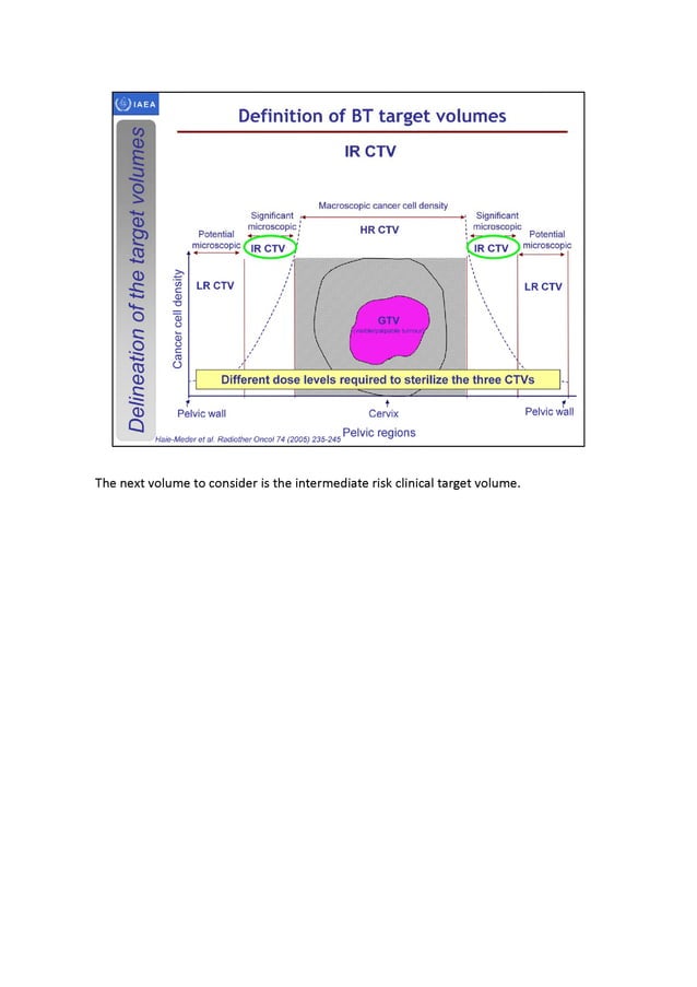 3D brachytherapy - definition and delineation of the target volumes ...
