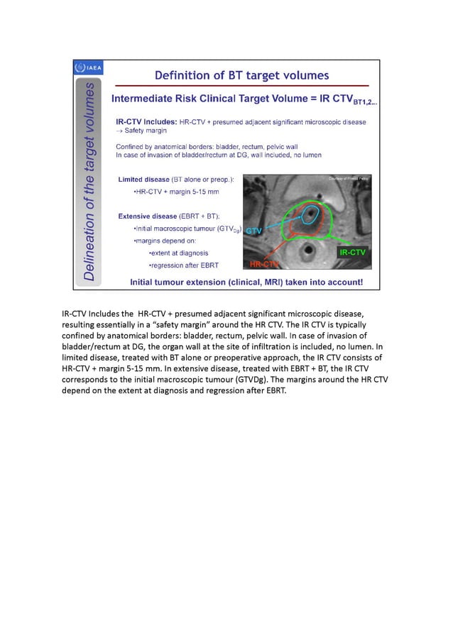 3D brachytherapy - definition and delineation of the target volumes ...