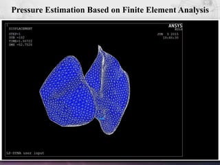 50
Pressure Estimation Based on Finite Element Analysis
 