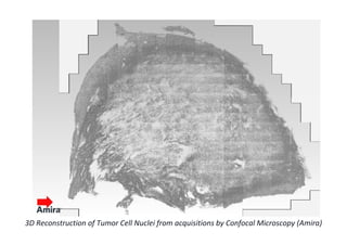 3D Reconstruction of Tumor Cell Nuclei from acquisitions by Confocal Microscopy (Amira)
 