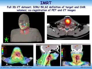 Implementing 3D conformal radiotherapy and IMRT Implementing 3D ...