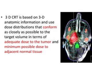 • 3 D CRT is based on 3-D
anatomic information and use
dose distributions that conform
as closely as possible to the
target volume in terms of
adequate dose to the tumor and
minimum possible dose to
adjacent normal tissue
 