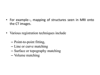 • For example--, mapping of structures seen in MRI onto
the CT images.
• Various registration techniques include
– Point-to-point fitting,
– Line or curve matching
– Surface or topography matching
– Volume matching
 