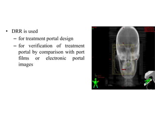 • DRR is used
– for treatment portal design
– for verification of treatment
portal by comparison with port
films or electronic portal
images
 