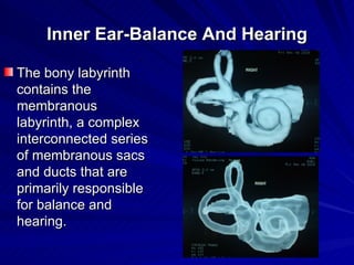 Inner Ear-Balance And Hearing

The bony labyrinth
contains the
membranous
labyrinth, a complex
interconnected series
of me...