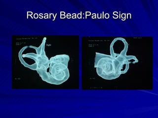 Rosary Bead:Paulo Sign
 