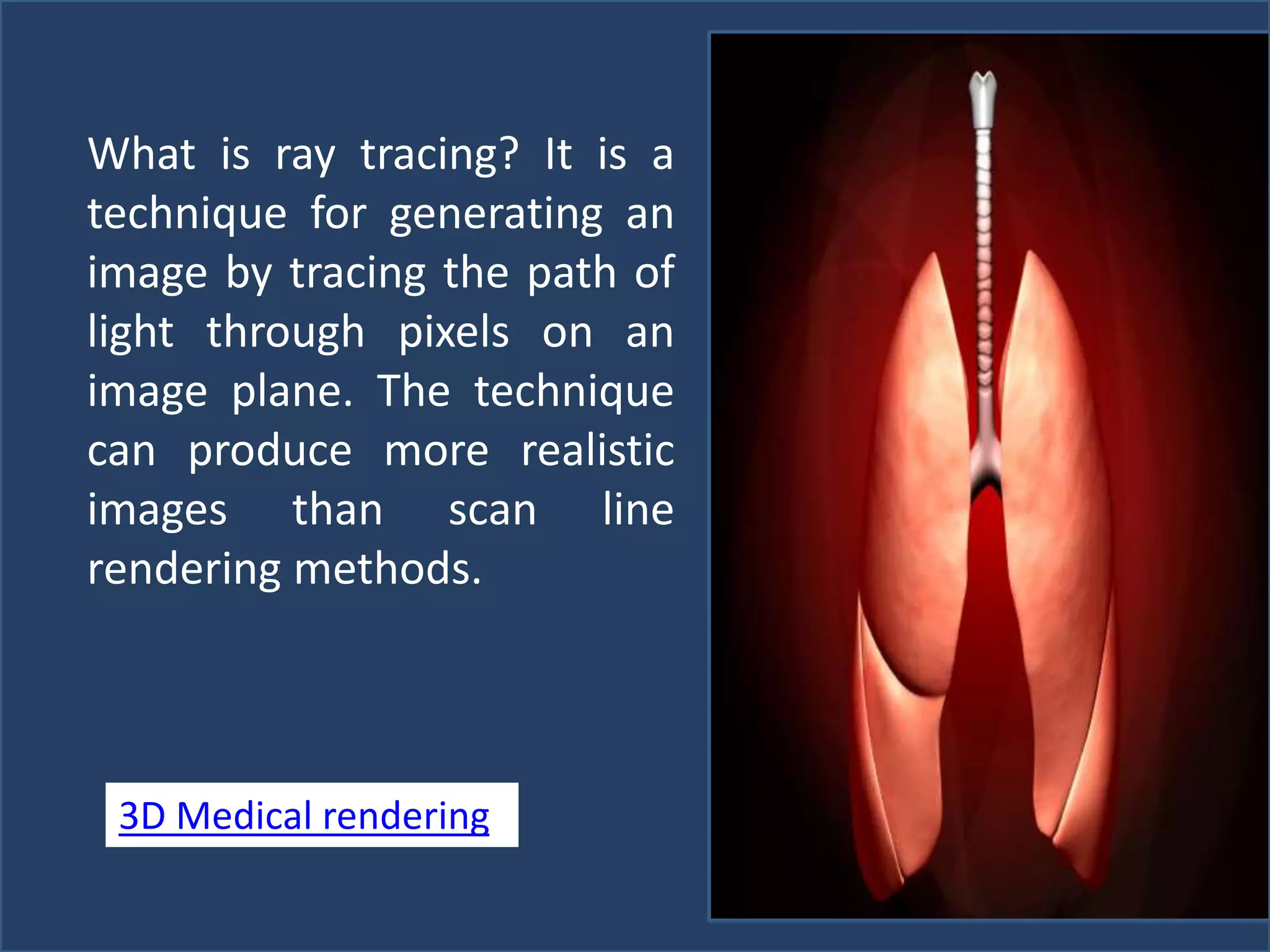 What is ray tracing? It is a
technique for generating an
image by tracing the path of
light through pixels on an
image plane. The technique
can produce more realistic
images than scan line
rendering methods.
3D Medical rendering
 
