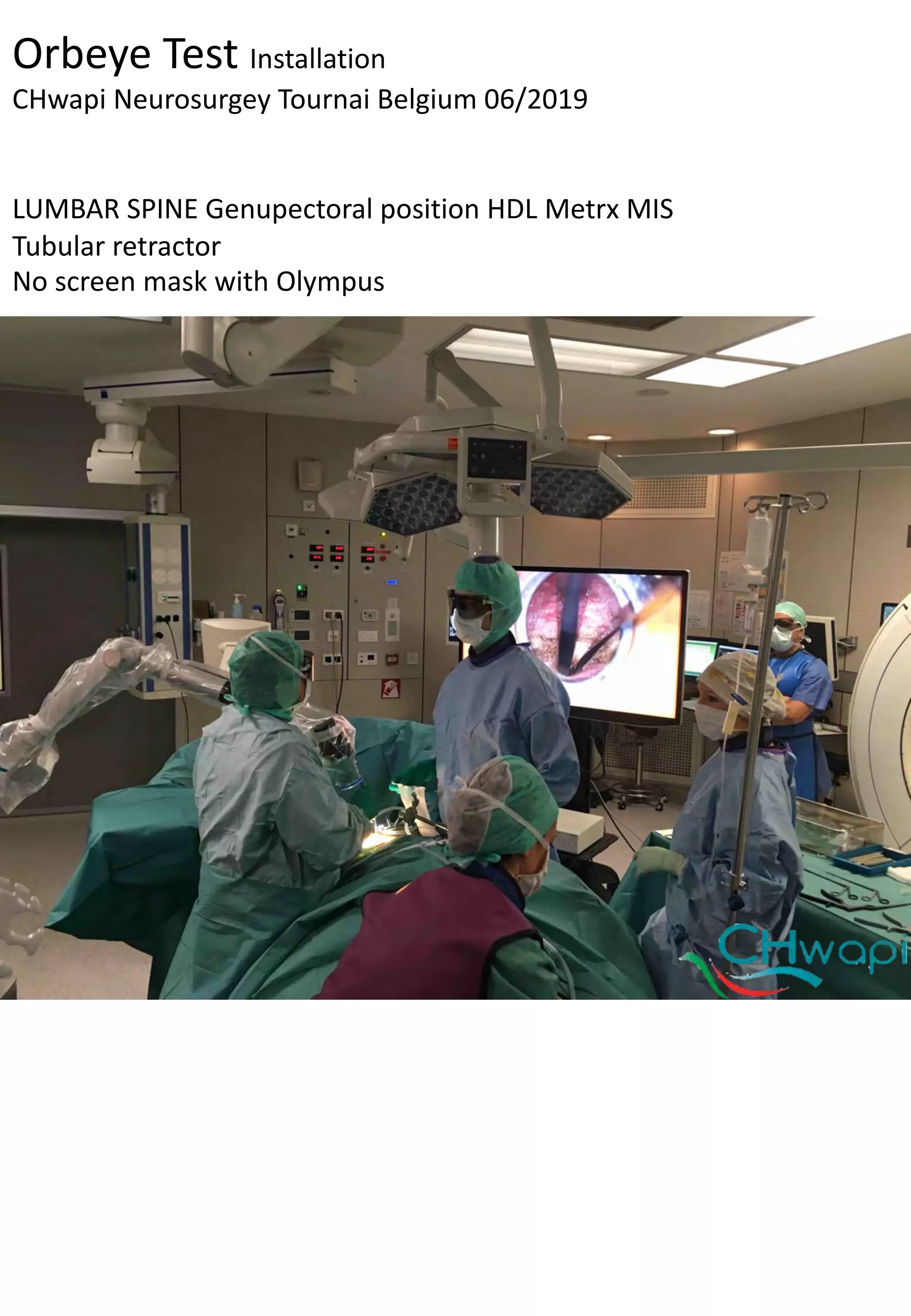 Microsurgery without eyepieces 3D screen heads-up position