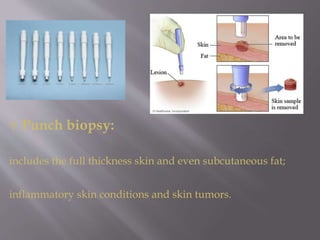 Punch Incision Derma 3 Dermatopathology.pptx