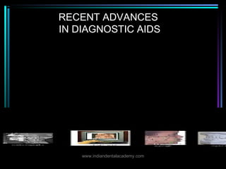 RECENT ADVANCES
IN DIAGNOSTIC AIDS
www.indiandentalacademy.com
 