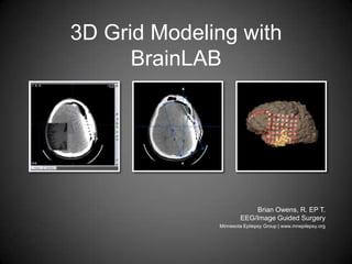 3D Grid Modeling with BrainLAB Brian Owens, R. EP T.EEG/Image Guided Surgery Minnesota Epilepsy Group | www.mnepilepsy.org 