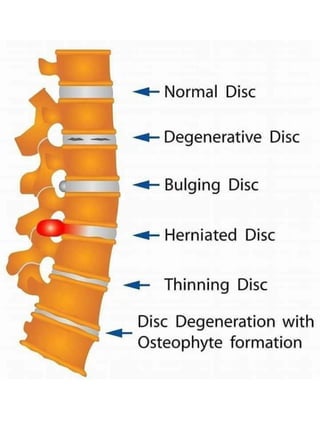 3D  Human internal organs skeleton structure.pptx