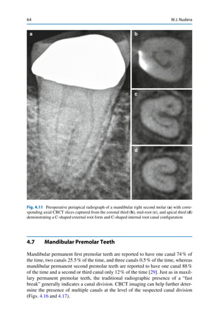 3 d imaging in endodontics a new era in diagnosis and treatment | PDF
