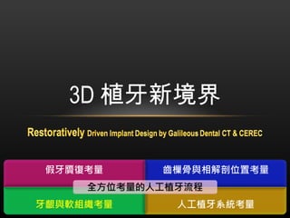 3D 植牙新境界 