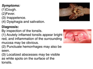 Symptoms:
(1)Cough.
(2)Fever.
(3) Inappetence.
(4) Dysphagia and salivation.
Diagnosis:
By inspection of the tonsils.
(1) Acutely inﬂamed tonsils appear bright
red, and inﬂammation of the surrounding
mucosa may be obvious.
(2) Punctuate hemorrhages may also be
seen.
(3) Localized abscesses may be visible
as white spots on the surface of the
tonsils.
 