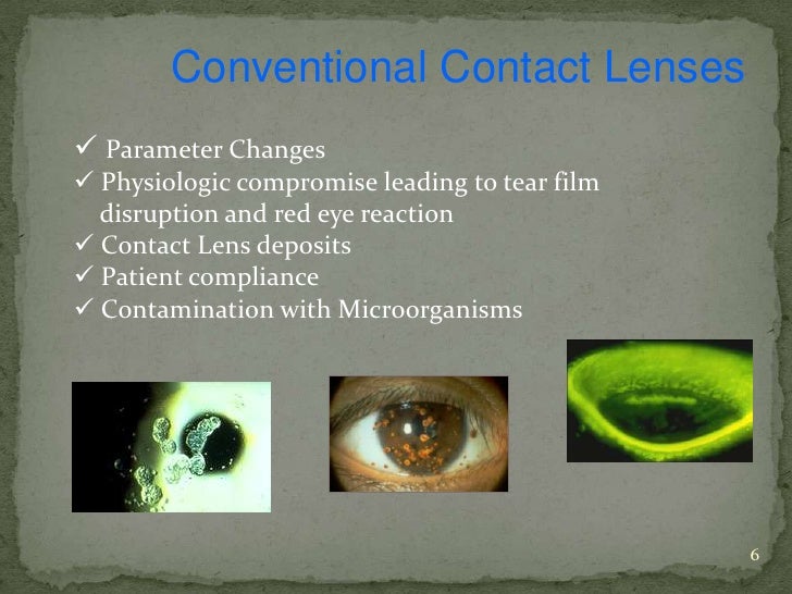 disposable contact lenses