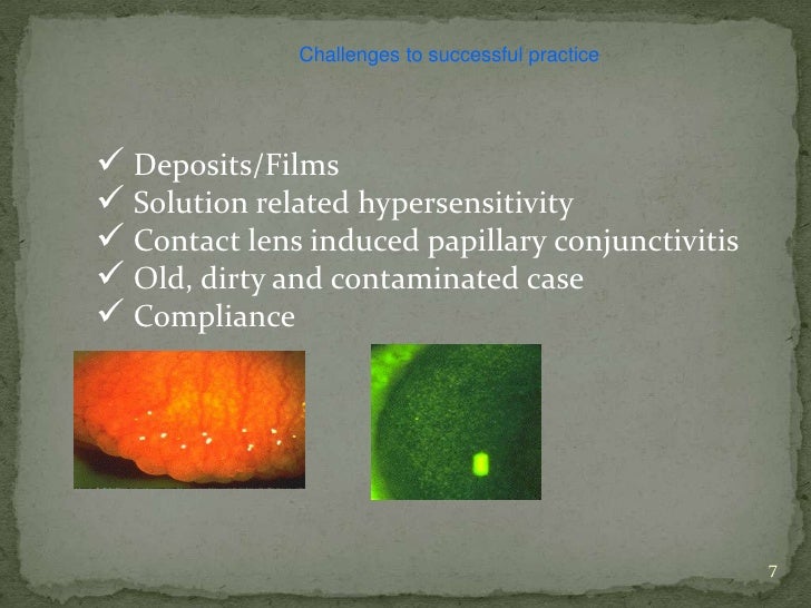 disposable contact lenses