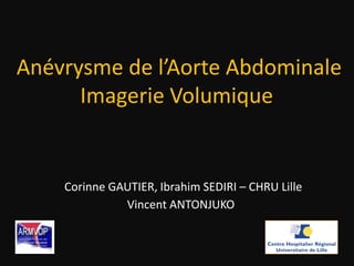 Anévrysme de l’Aorte Abdominale
Imagerie Volumique
Corinne GAUTIER, Ibrahim SEDIRI – CHRU Lille
Vincent ANTONJUKO
 
