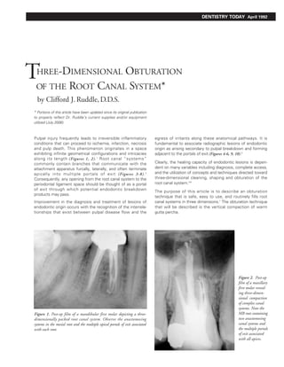 DENTISTRY TODAY April 1992




THREE-DIMENSIONAL OBTURATION
 OF THE ROOT CANAL SYSTEM*
  by Clifford J. Ruddle, D.D.S.
* Portions of this article have been updated since its original publication
to properly reflect Dr. Ruddle’s current supplies and/or equipment
utilized (July 2006).



Pulpal injury frequently leads to irreversible inflammatory                     egress of irritants along these anatomical pathways. It is
conditions that can proceed to ischemia, infarction, necrosis                   fundamental to associate radiographic lesions of endodontic
and pulp death. This phenomenon originates in a space                           origin as arising secondary to pulpal breakdown and forming
exhibiting infinite geometrical configurations and intricacies                  adjacent to the portals of exit (Figures 4-6, 9, 10).3
along its length (Figures 1, 2). 1 Root canal “systems”
commonly contain branches that communicate with the                             Clearly, the healing capacity of endodontic lesions is depen-
attachment apparatus furcally, laterally, and often terminate                   dent on many variables including diagnosis, complete access,
apically into multiple portals of exit (Figures 3-8). 2                         and the utilization of concepts and techniques directed toward
Consequently, any opening from the root canal system to the                     three-dimensional cleaning, shaping and obturation of the
periodontal ligament space should be thought of as a portal                     root canal system.4-6
of exit through which potential endodontic breakdown
                                                                                The purpose of this article is to describe an obturation
products may pass.
                                                                                technique that is safe, easy to use, and routinely fills root
Improvement in the diagnosis and treatment of lesions of                        canal systems in three dimensions.7 The obturation technique
endodontic origin occurs with the recognition of the interrela-                 that will be described is the vertical compaction of warm
tionships that exist between pulpal disease flow and the                        gutta percha.




                                                                                                                              Figure 2. Post-op
                                                                                                                              film of a maxillary
                                                                                                                              first molar reveal-
                                                                                                                              ing three-dimen-
                                                                                                                              sional compaction
                                                                                                                              of complex canal
                                                                                                                              systems. Note the
Figure 1. Post-op film of a mandibular first molar depicting a three-                                                         MB root containing
dimensionally packed root canal system. Observe the anastomosing                                                              two anastomosing
systems in the mesial root and the multiple apical portals of exit associated                                                 canal systems and
with each root.                                                                                                               the multiple portals
                                                                                                                              of exit associated
                                                                                                                              with all apices.
 