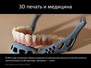 http://geektimes.ru/post/237699/
3D печать и медицина
В 2012 году состоялась первая операция по вживлению импланта нижней челюсти,
напечатанного на 3D принтере. Материал — титан.
 