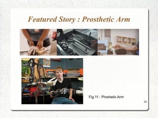 20
Featured Story : Prosthetic Arm
Fig 11 : Proshetic Arm
 