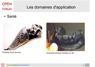 ●

Santé

Prothèse Scott Summit

Empreinte dentaire réalisée en 3D

 