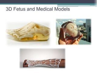 3D Fetus and Medical Models
 