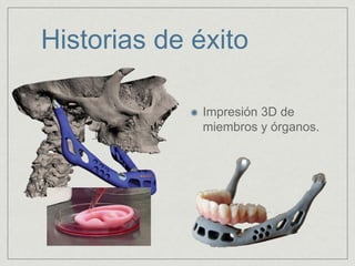 Historias de éxito
Impresión 3D de
miembros y órganos.
 