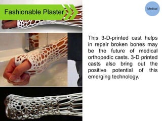 Fashionable Plaster
This 3-D-printed cast helps
in repair broken bones may
be the future of medical
orthopedic casts. 3-D printed
casts also bring out the
positive potential of this
emerging technology.
Medical
 