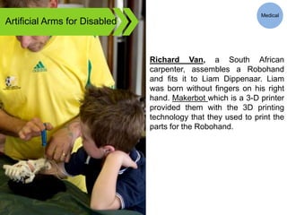 Artificial Arms for Disabled
Richard Van, a South African
carpenter, assembles a Robohand
and fits it to Liam Dippenaar. Liam
was born without fingers on his right
hand. Makerbot which is a 3-D printer
provided them with the 3D printing
technology that they used to print the
parts for the Robohand.
Medical
 
