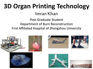 3D Organ Printing Technology
Imran Khan
Post-Graduate Student
Department of Burn Reconstruction
First Affiliated Hospital of Zhengzhou University
 