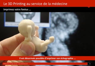 Le	
  3D	
  Prin?ng	
  au	
  service	
  de	
  la	
  médecine
Imprimez	
  votre	
  foetus	
  ...
	
  
	
  
©HUB	
  Ins?tute.	
  All	
  rights	
  reserved	
  	
  |	
  www.HUBins?tute.com 31	
  
Il	
  est	
  désormais	
  possible	
  d’imprimer	
  son	
  échographie	
  ...
 