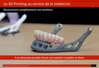 Le	
  3D	
  Prin?ng	
  au	
  service	
  de	
  la	
  médecine
Reconstruire	
  complétement	
  une	
  machoire
hop://www.singularityweblog.com/the-­‐ﬁrst-­‐3d-­‐printed-­‐jaw-­‐implant/
©HUB	
  Ins?tute.	
  All	
  rights	
  reserved	
  	
  |	
  www.HUBins?tute.com 31	
  
Il	
  est	
  désormais	
  possible	
  d’avoir	
  une	
  machoire	
  complète	
  en	
  (tane
 