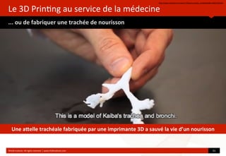 Le	
  3D	
  Prin?ng	
  au	
  service	
  de	
  la	
  médecine
...	
  ou	
  de	
  fabriquer	
  une	
  trachée	
  de	
  nourisson
hop://www.youtube.com/watch?feature=player_embedded&v=O82nC9ro6Io
©HUB	
  Ins?tute.	
  All	
  rights	
  reserved	
  	
  |	
  www.HUBins?tute.com 31	
  
Une	
  a[elle	
  trachéale	
  fabriquée	
  par	
  une	
  imprimante	
  3D	
  a	
  sauvé	
  la	
  vie	
  d’un	
  nourisson
 