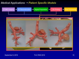 September 8, 2016 Tri-C R3D 2016 15
Medical Applications  Patient Specific Models
CT/MR Imaging 3D Reconstruction Digital Preparation 3D Printing Post Processing
 