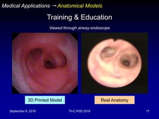 September 8, 2016 Tri-C R3D 2016 17
3D Printed Model Real Anatomy
Viewed through airway endoscope
Medical Applications  Anatomical Models
Training & Education
 