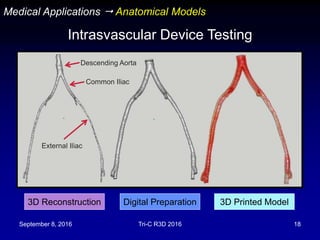 September 8, 2016 Tri-C R3D 2016 18
3D Reconstruction Digital Preparation 3D Printed Model
Descending Aorta
Medical Applications  Anatomical Models
Intrasvascular Device Testing
Common Iliac
External Iliac
 