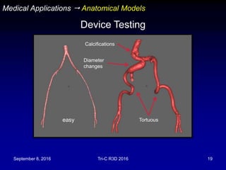 September 8, 2016 Tri-C R3D 2016 19
Medical Applications  Anatomical Models
Device Testing
easy Tortuous
Calcifications
Diameter
changes
 