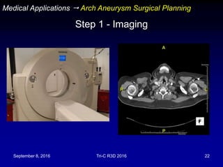September 8, 2016 Tri-C R3D 2016 22
Step 1 - Imaging
Medical Applications  Arch Aneurysm Surgical Planning
 