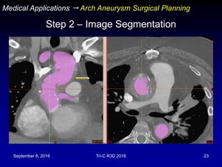 September 8, 2016 Tri-C R3D 2016 23
Step 2 – Image Segmentation
Medical Applications  Arch Aneurysm Surgical Planning
 