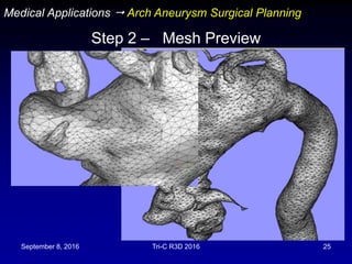 September 8, 2016 Tri-C R3D 2016 25
Step 2 – Mesh Preview
Medical Applications  Arch Aneurysm Surgical Planning
 
