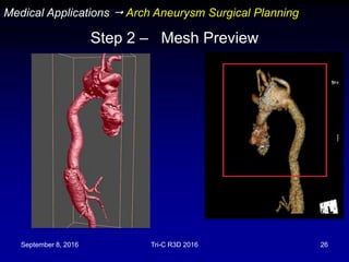 September 8, 2016 Tri-C R3D 2016 26
Step 2 – Mesh Preview
Medical Applications  Arch Aneurysm Surgical Planning
 