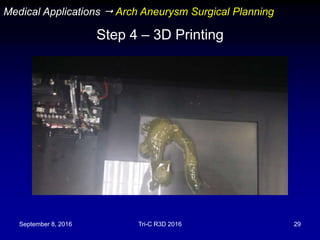 September 8, 2016 Tri-C R3D 2016 29
Step 4 – 3D Printing
Medical Applications  Arch Aneurysm Surgical Planning
 