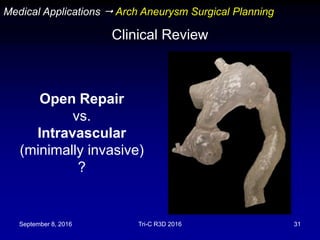September 8, 2016 Tri-C R3D 2016 31
Clinical Review
Medical Applications  Arch Aneurysm Surgical Planning
Open Repair
vs.
Intravascular
(minimally invasive)
?
 