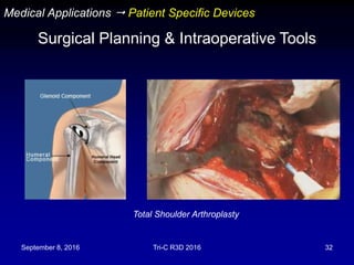 September 8, 2016 Tri-C R3D 2016 32
Total Shoulder Arthroplasty
Medical Applications  Patient Specific Devices
Surgical Planning & Intraoperative Tools
 