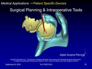 September 8, 2016 Tri-C R3D 2016 33
Joseph P Iannotti et al, “ Comparison of Patient-Specific Instruments with Standard Surgical Instruments
in Determining Glenoid Component Position”, 2012 Journal of Bone and Joint Surgery Vol 94-A
Digital Surgical Planning
Medical Applications  Patient Specific Devices
Surgical Planning & Intraoperative Tools
 
