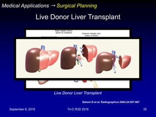 September 8, 2016 Tri-C R3D 2016 35
Medical Applications  Surgical Planning
Live Donor Liver Transplant
Live Donor Liver Transplant
Sahani D et al. Radiographics 2004;24:957-967
 