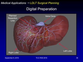 September 8, 2016 Tri-C R3D 2016 36
Medical Applications  LDLT Surgical Planning
Digital Preparation
Planned
Resection
Line
Left Lobe
Right Lobe
Vena Cava
 