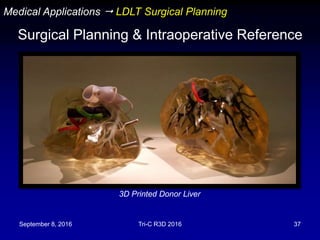 September 8, 2016 Tri-C R3D 2016 37
Medical Applications  LDLT Surgical Planning
Surgical Planning & Intraoperative Reference
3D Printed Donor Liver
 