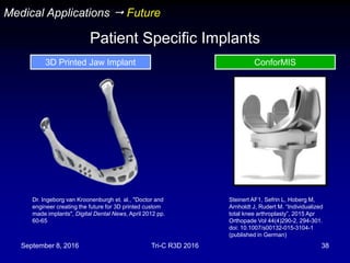 September 8, 2016 Tri-C R3D 2016 38
Dr. Ingeborg van Kroonenburgh et. al., "Doctor and
engineer creating the future for 3D printed custom
made implants", Digital Dental News, April 2012 pp.
60-65
Steinert AF1, Sefrin L, Hoberg M,
Arnholdt J, Rudert M. “Individualized
total knee arthroplasty”, 2015 Apr
Orthopade Vol 44(4)290-2, 294-301.
doi: 10.1007/s00132-015-3104-1
(published in German)
Medical Applications  Future
Patient Specific Implants
3D Printed Jaw Implant ConforMIS
 